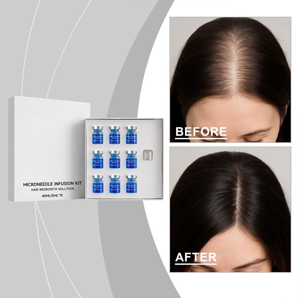 Hair Care Oil Serum - 0.25 ミリメートルヘアエッセンシャルセラムマイクロニードルローラーセット毛包栄養頭皮ヘアケア髪を厚くするコンディショナーエッセンス