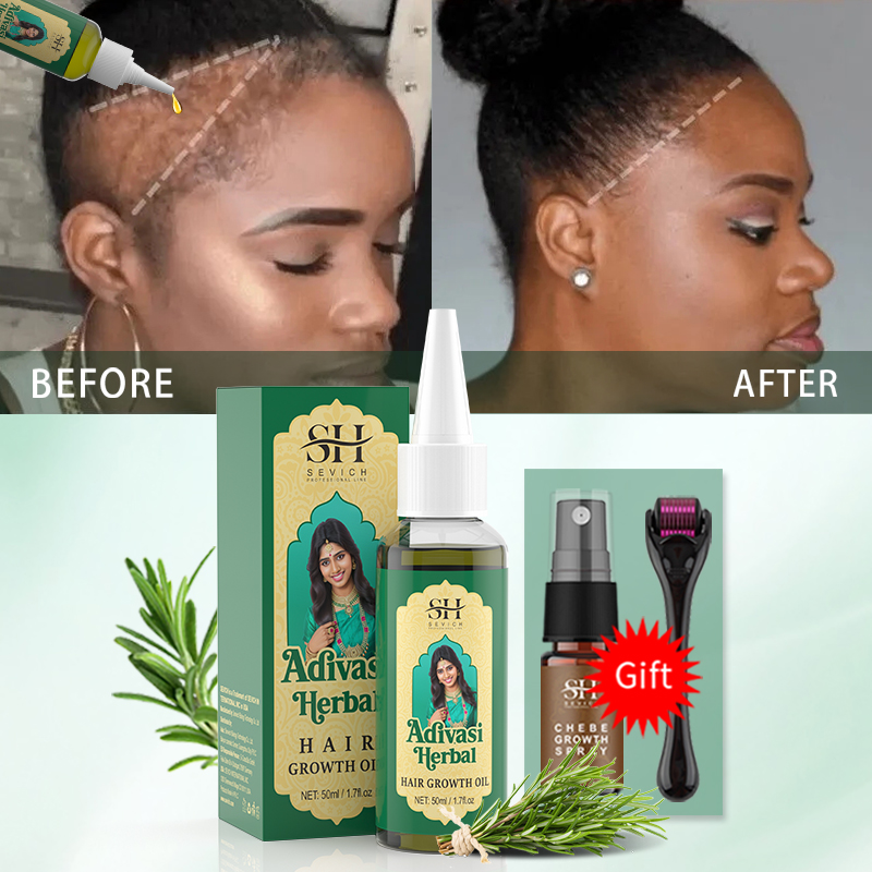 アーユルヴェーダヘアグロースオイル インドアディヴァシハーブ - Hair Care Fragrance Essential Oil のレビューと価格