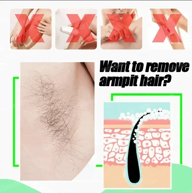 脱毛スプレー 強力な除毛効果 健康的で痛みのない脱毛抑制剤  - Hair Care Korea のレビューと価格