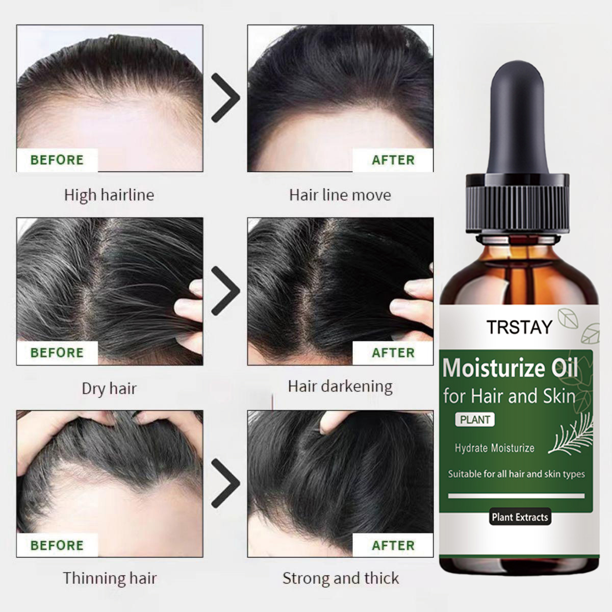 TRSTAY ローズマリー エッセンシャル オイル 髪と頭皮 - Rosemary Hair Oil のレビューと価格