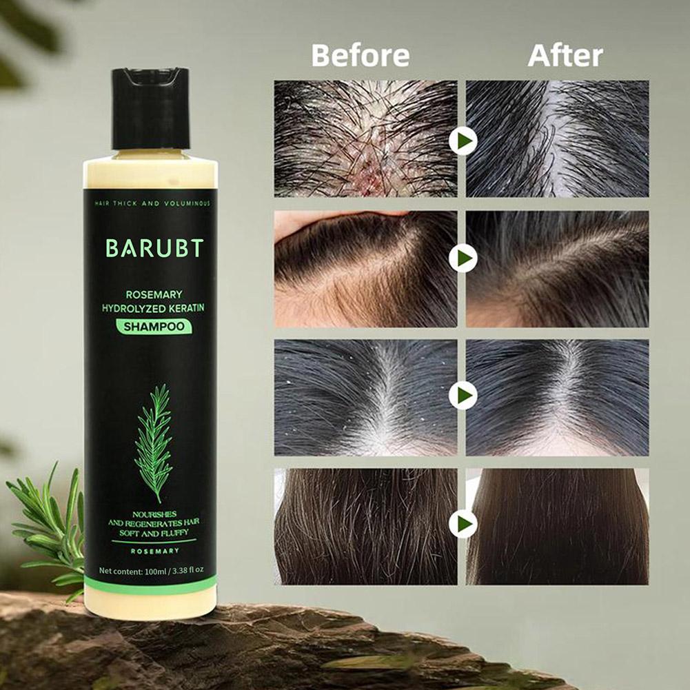 ローズマリーシャンプー 育毛 深層洗浄 頭皮ケア フケ防止  - Rosemary Hair Oil のレビューと価格