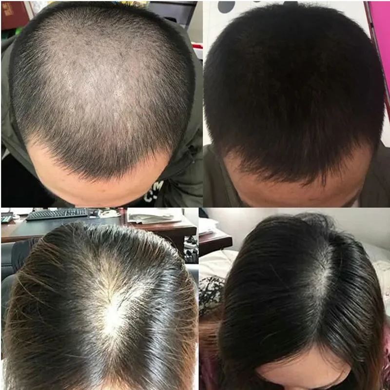 オーバーロードプラント育毛液は抜け毛を防ぎ、根の固定を強化す - Hair Care Or Haircare のレビューと価格