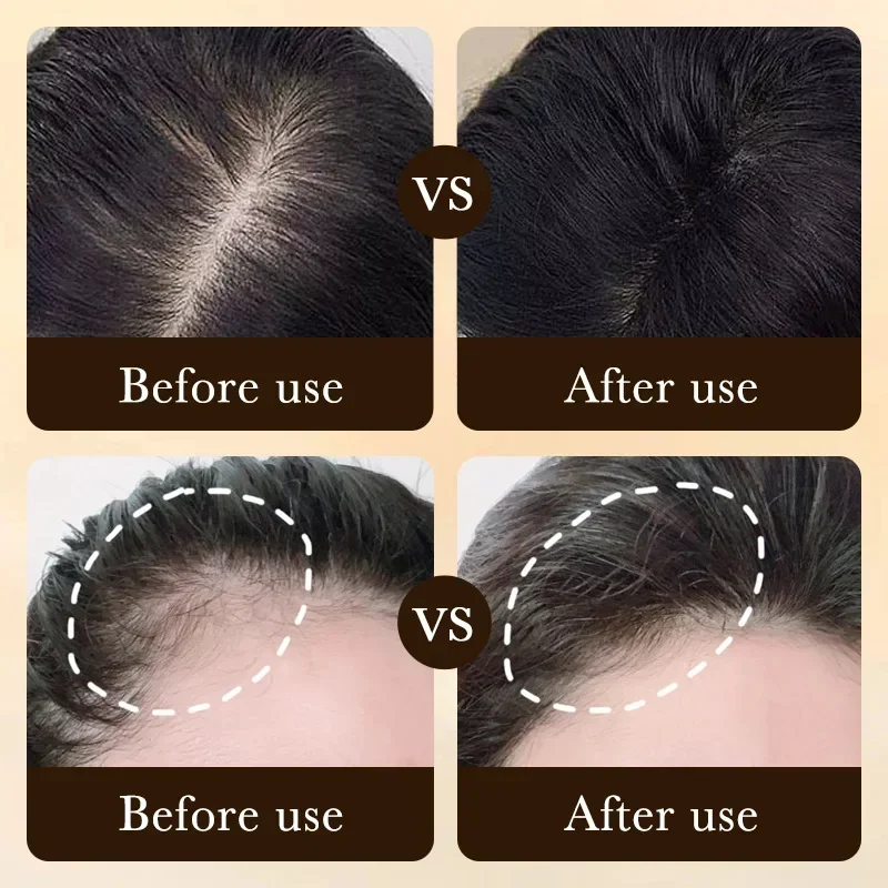 ビオチン配合育毛オイル製品、頭皮マッサージトリートメント、脱 - Hair Care Fragrance Essential Oil のレビューと価格