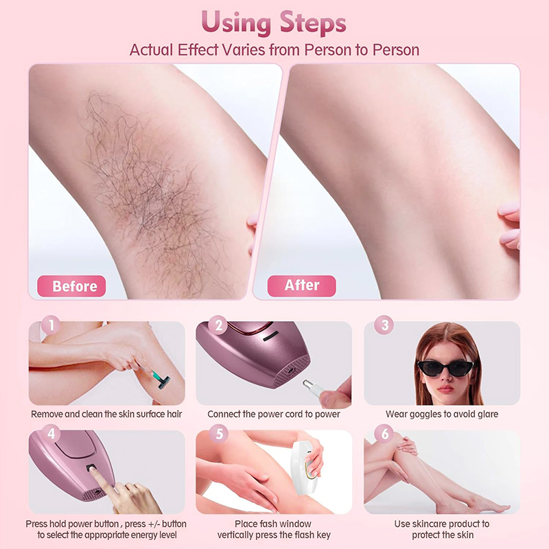 IPL レーザー脱毛器ヘアカットマシンストレートナー振動シェ - Hair Care Or Haircare のレビューと価格