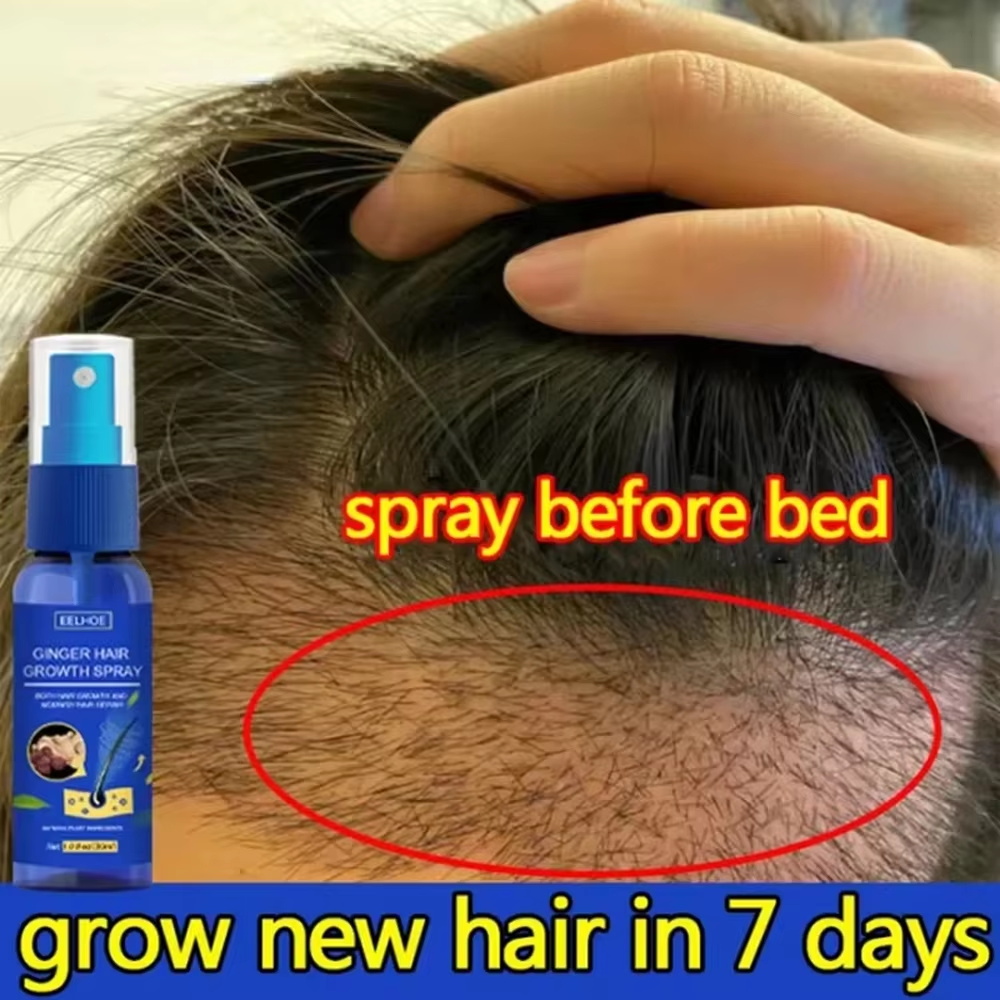 速効性ジンジャーヘアグローススプレー、毛根育成、脱毛防止、育 - Hair Care Nature のレビューと価格